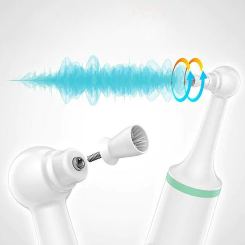 Elektrický odstraňovač zubného kameňa - Ústna hygiena a žiarivý úsmev